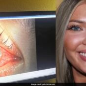 US Woman, 23, Goes Blind In One Eye After Swimming With Contact Lenses